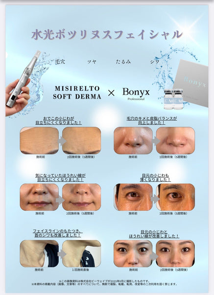 ボツリヌストキシン美容液(ボニックス LCオーラ キット)成長因子×Hugro-Wコンプレックス配合 ホームケア美容液（MTSスタンプ付）